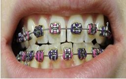 141 Orthodontics